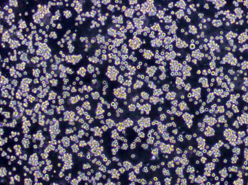 REC-1 Lymphoblast Cell|人淋巴瘤传代细胞(有STR鉴定),REC-1 Lymphoblast Cell