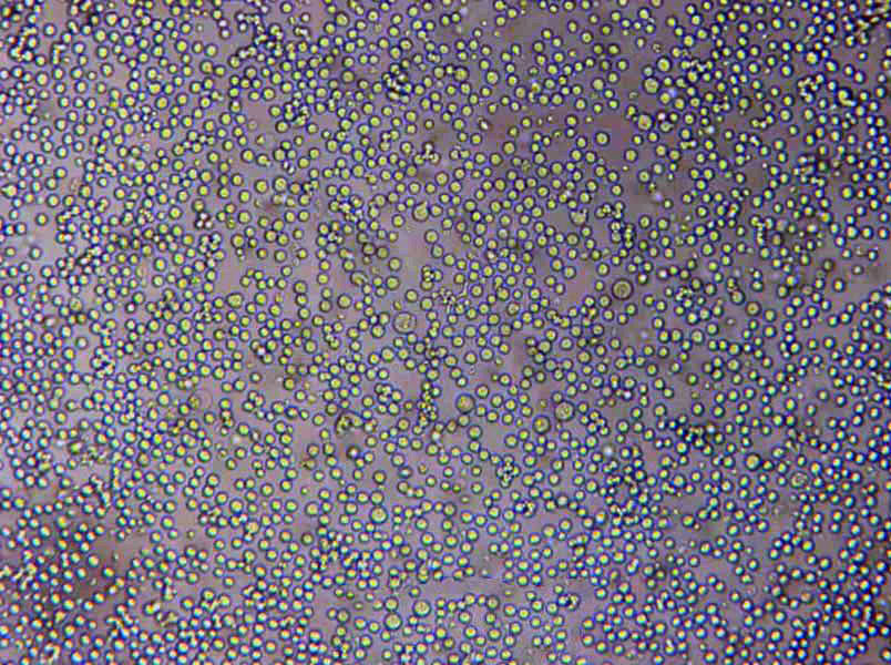 CCRF-CEM Lymphoblast Cell|人急性淋巴细胞白血病T淋巴传代细胞(有STR鉴定),CCRF-CEM Lymphoblast Cell