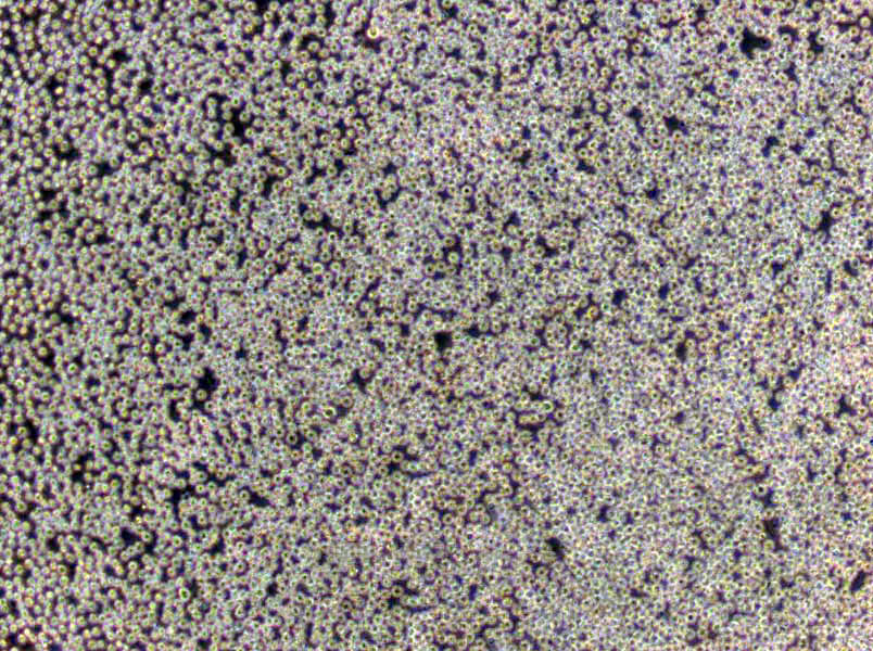 Jurkat Lymphoblast Cell|人急性T淋巴细胞白血病传代细胞(有STR鉴定),Jurkat Lymphoblast Cell