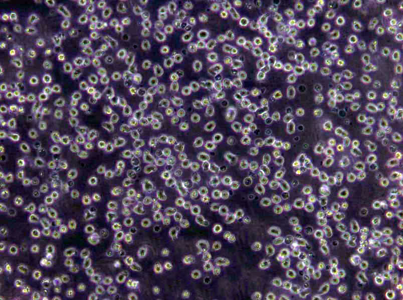 MT-2 Lymphoblast Cell|人淋巴瘤傳代細(xì)胞(有STR鑒定),MT-2 Lymphoblast Cell