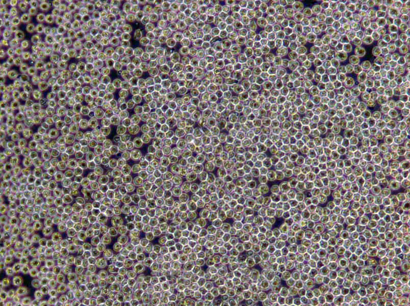 6T-CEM Lymphoblast Cell|人T細(xì)胞白血病傳代細(xì)胞(有STR鑒定),6T-CEM Lymphoblast Cell