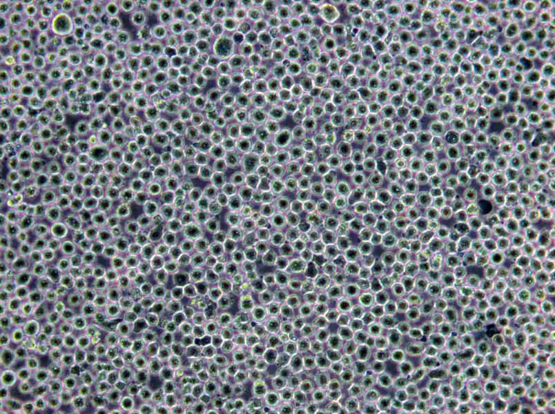 Ku812F Lymphoblast Cell|人外周血嗜堿性白血病傳代細(xì)胞(有STR鑒定),Ku812F Lymphoblast Cell