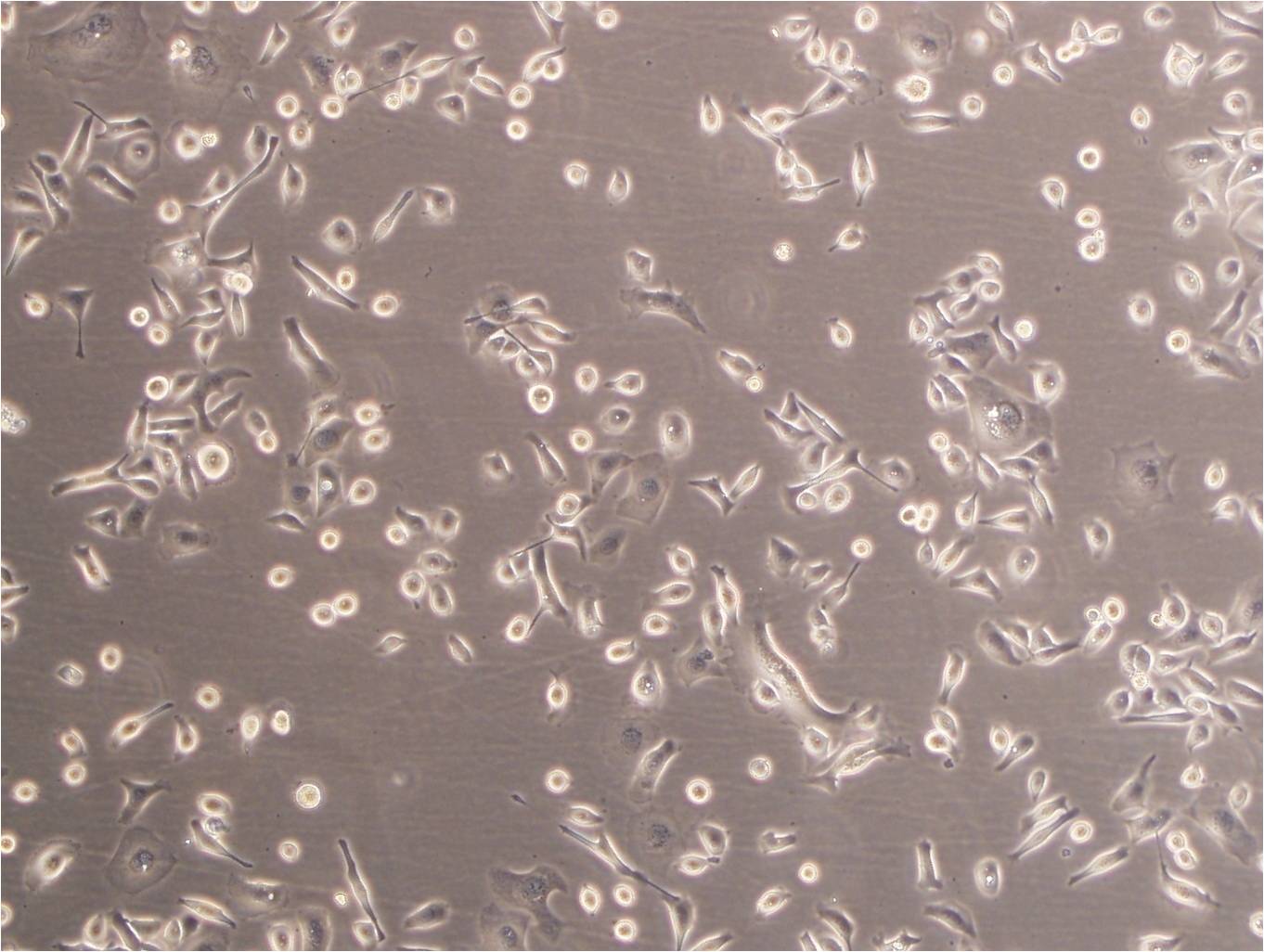 HCC827 Epithelial Cell|人非小细胞肺癌传代细胞(有STR鉴定),HCC827 Epithelial Cell
