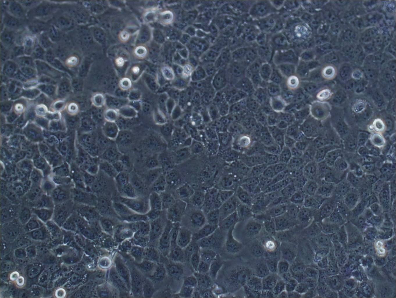 SNU-398 Epithelial Cell|人肝癌傳代細(xì)胞(有STR鑒定),SNU-398 Epithelial Cell