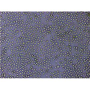 T2 Lymphoblast Cell|人淋巴母传代细胞(有STR鉴定