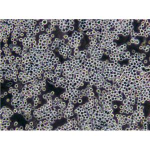 ANA-1 Lymphoblast Cell|小鼠巨噬傳代細(xì)胞(有STR鑒定),ANA-1 Lymphoblast Cell