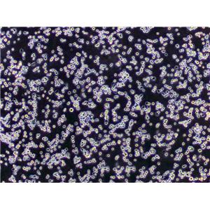 Reh Lymphoblast Cell|人急性非B非T淋巴细胞性白血病传代细胞(有STR鉴定),Reh Lymphoblast Cell