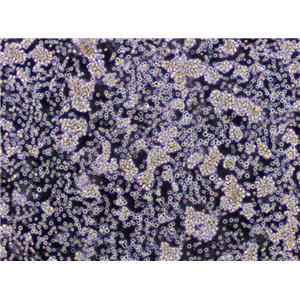 Loucy Lymphoblast Cell|人淋巴细胞白血病传代细胞(有STR鉴定)