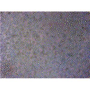 CCRF-CEM Lymphoblast Cell|人急性淋巴细胞白血病T淋巴传代细胞(有STR鉴定),CCRF-CEM Lymphoblast Cell