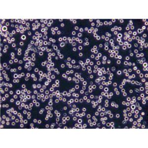 NALM-6 Lymphoblast Cell|人急性B淋巴白血病传代细胞(有STR鉴定),NALM-6 Lymphoblast Cell