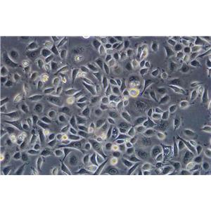 SMMC-7721 Epithelial Cell|人肝癌传代细胞(有STR鉴定)