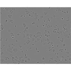 QGY-7701 Epithelial Cell|人肝癌传代细胞(有STR鉴定),QGY-7701 Epithelial Cell