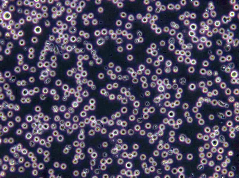 Karpas-299 Lymphoblast Cell|人间变性大细胞淋巴瘤传代细胞(有STR鉴定),Karpas-299 Lymphoblast Cell