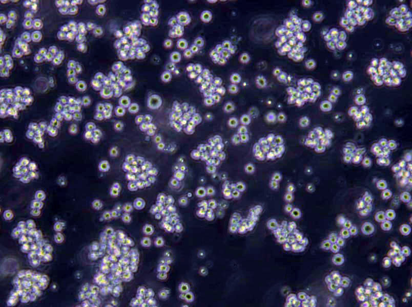 KOPN-8 Lymphoblast Cell|人B淋巴细胞白血病传代细胞(有STR鉴定),KOPN-8 Lymphoblast Cell