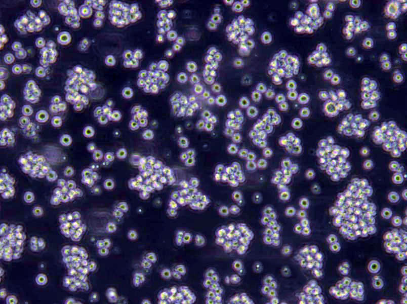 OCI-Ly1 Lymphoblast Cell|人弥漫大B淋巴瘤传代细胞(有STR鉴定),OCI-Ly1 Lymphoblast Cell