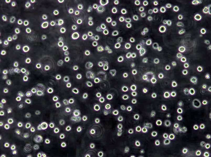 OCI-Ly19 Lymphoblast Cell|人弥漫大B淋巴瘤传代细胞(有STR鉴定),OCI-Ly19 Lymphoblast Cell