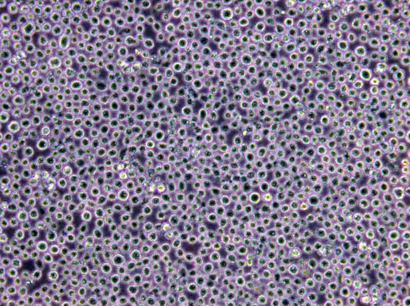 AHH-1 Lymphoblast Cell|人外周血B淋巴传代细胞(有STR鉴定),AHH-1 Lymphoblast Cell