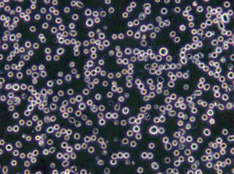 MOLM-13 Lymphoblast Cell|人急性髓系白血病传代细胞(有STR鉴定),MOLM-13 Lymphoblast Cell