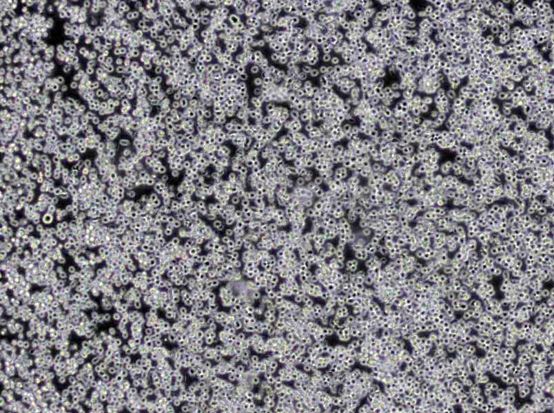 HBL-1 [Human diffuse large B-cell lymphoma] Lymphoblast Cell|人弥漫大B淋巴瘤传代细胞(有STR鉴定),HBL-1 [Human diffuse large B-cell lymphoma] Lymphoblast Cell