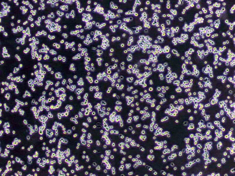 MT-3 [Human leukocytes] Lymphoblast Cell|人臍血白傳代細(xì)胞(有STR鑒定),MT-3 [Human leukocytes] Lymphoblast Cell