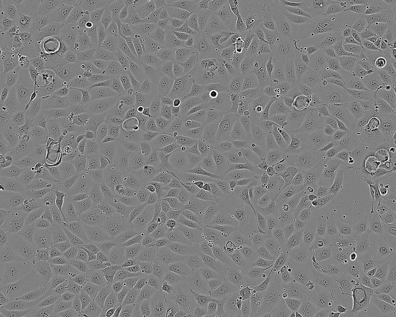 Tu 177 Epithelial Cell|人喉鳞癌传代细胞(有STR鉴定),Tu 177 Epithelial Cell