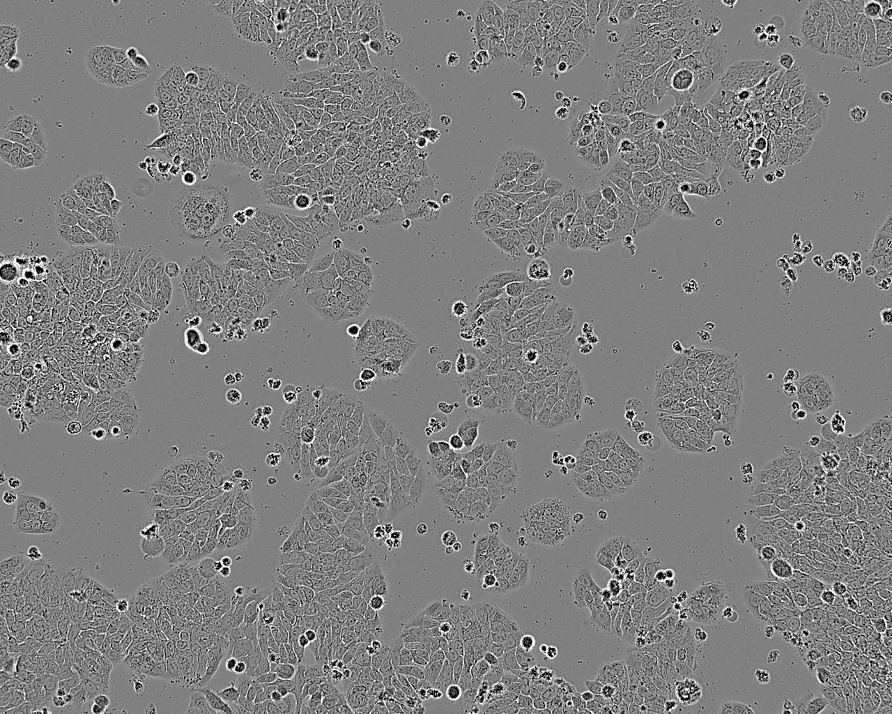 NCI-H1975 Epithelial Cell|人肺腺癌传代细胞(有STR鉴定),NCI-H1975 Epithelial Cell