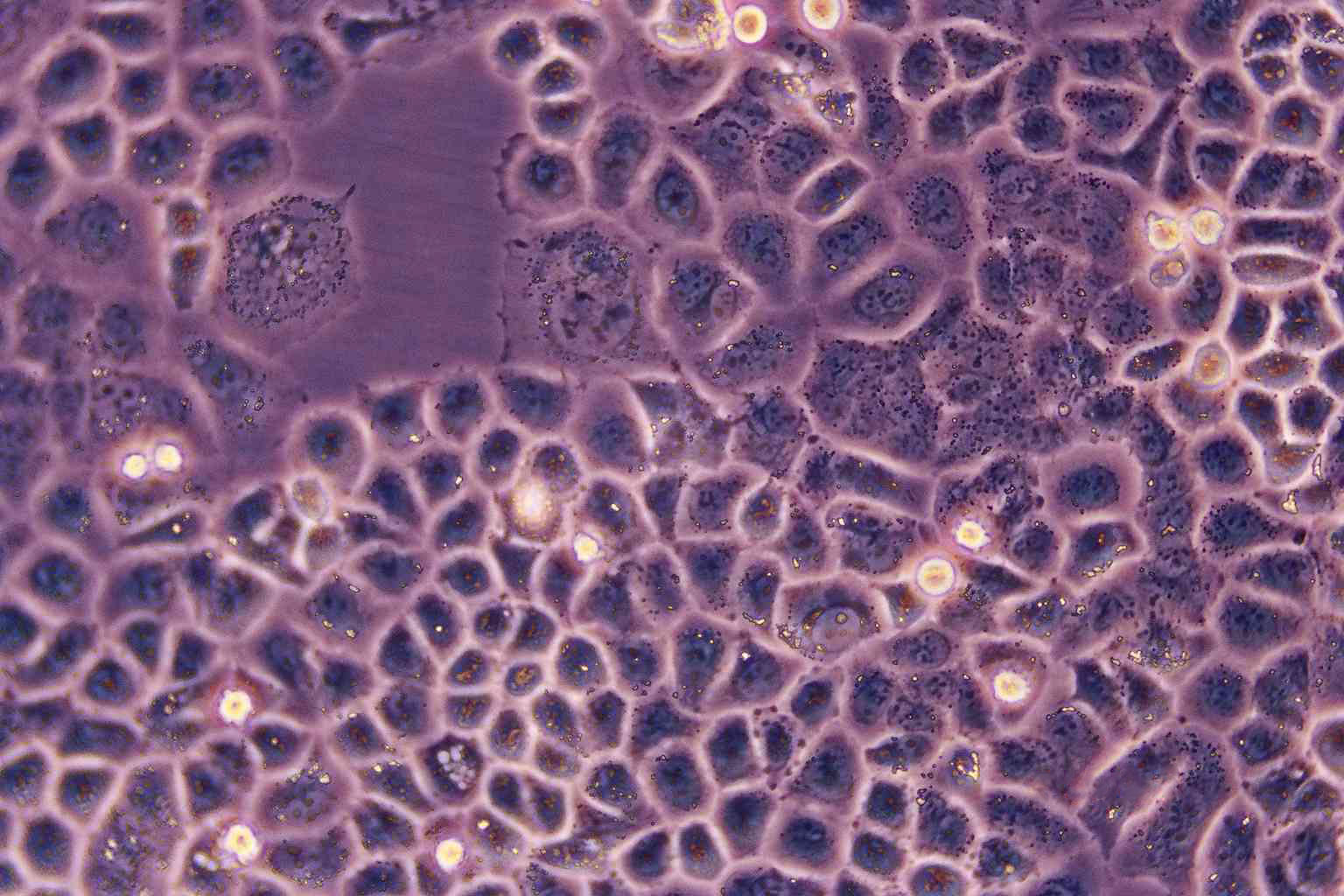 ES-2 Epithelial Cell|人卵巢癌传代细胞(有STR鉴定),ES-2 Epithelial Cell