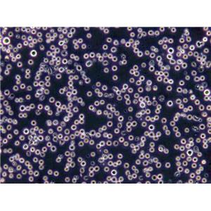Karpas-299 Lymphoblast Cell|人间变性大细胞淋巴瘤传代细胞(有STR鉴定)
