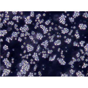 KOPN-8 Lymphoblast Cell|人B淋巴细胞白血病传代细胞(有STR鉴定),KOPN-8 Lymphoblast Cell