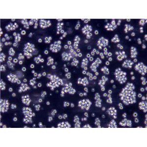 OCI-Ly1 Lymphoblast Cell|人弥漫大B淋巴瘤传代细胞(有STR鉴定),OCI-Ly1 Lymphoblast Cell