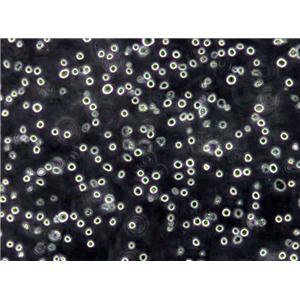 OCI-Ly19 Lymphoblast Cell|人弥漫大B淋巴瘤传代细胞(有STR鉴定),OCI-Ly19 Lymphoblast Cell
