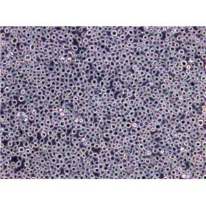 AHH-1 Lymphoblast Cell|人外周血B淋巴传代细胞(有STR鉴定)