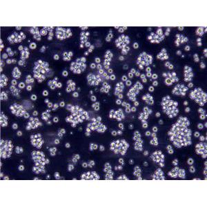 HDLM-2 Lymphoblast Cell|人霍奇金淋巴瘤传代细胞(有STR鉴定)