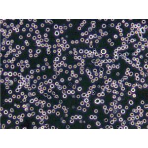 MOLM-13 Lymphoblast Cell|人急性髓系白血病传代细胞(有STR鉴定),MOLM-13 Lymphoblast Cell