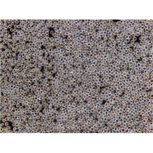 KHYG-1 Lymphoblast Cell|人NK细胞淋巴瘤传代细胞(有STR鉴定)