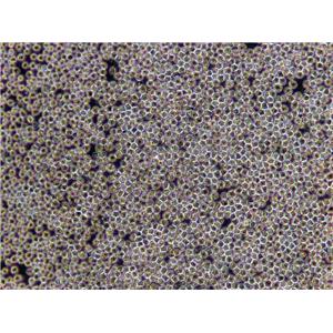 KHYG-1 Lymphoblast Cell|人NK细胞淋巴瘤传代细胞(有STR鉴定),KHYG-1 Lymphoblast Cell