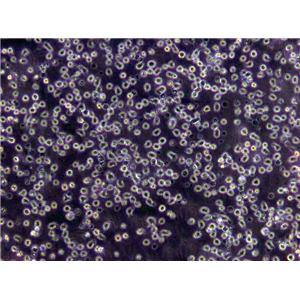 RPMI-6666 Lymphoblast Cell|人何杰金淋巴瘤传代细胞(有STR鉴定),RPMI-6666 Lymphoblast Cell