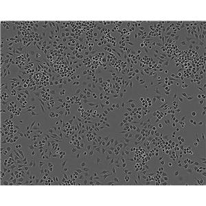 CL1-5 Epithelial Cell|人肺腺癌传代细胞(有STR鉴定)