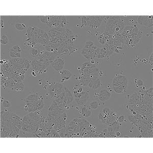 SCLC-21H Epithelial Cell|人小细胞肺癌传代细胞(有STR鉴定)