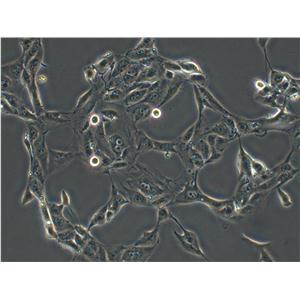NCI-H250 Epithelial Cell|人小细胞肺癌传代细胞(有STR鉴定)
