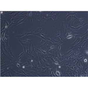 OVCAR-5 Epithelial Cell|人卵巢癌传代细胞(有STR鉴定)