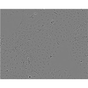 NCI-H441 Epithelial Cell|人肺腺癌傳代細(xì)胞(有STR鑒定),NCI-H441 Epithelial Cell