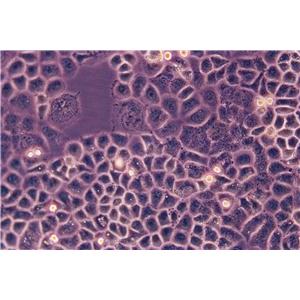 IMR-32 Epithelial Cell|人神经母细胞瘤传代细胞(有STR鉴定)