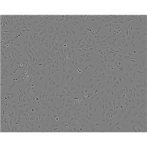 LNCaP Epithelial Cell|人前列腺癌传代细胞(有STR鉴定)