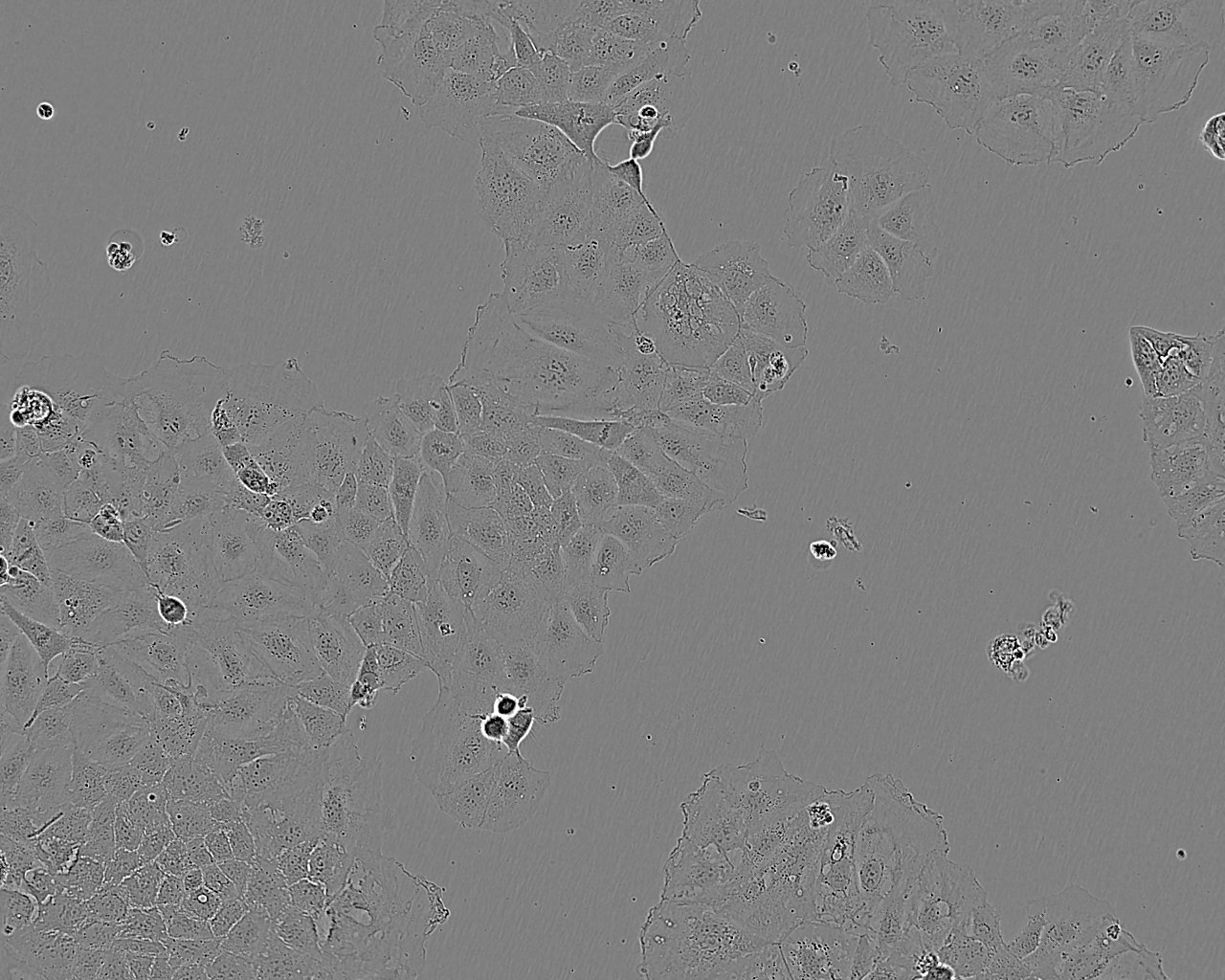 MDA-kb2 Epithelial Cell|人正常乳腺传代细胞(有STR鉴定),MDA-kb2 Epithelial Cell