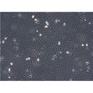 HBL-100 Epithelial Cell|人整合SV40基因的乳腺上皮传代细胞(有STR鉴定),HBL-100 Epithelial Cell