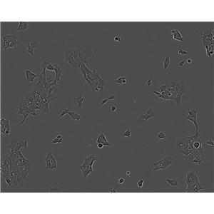 KYSE-450 Epithelial Cell|人食管癌传代细胞(有STR鉴定),KYSE-450 Epithelial Cell