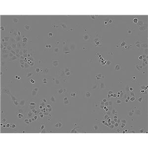 CaES-17 Epithelial Cell|人食管癌传代细胞(有STR鉴定),CaES-17 Epithelial Cell