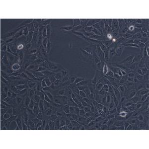 C2C12 Epithelial Cell|小鼠成肌传代细胞(有STR鉴定),C2C12 Epithelial Cell