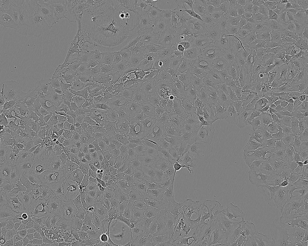 SW403 Epithelial Cell|人结肠腺癌传代细胞(有STR鉴定),SW403 Epithelial Cell